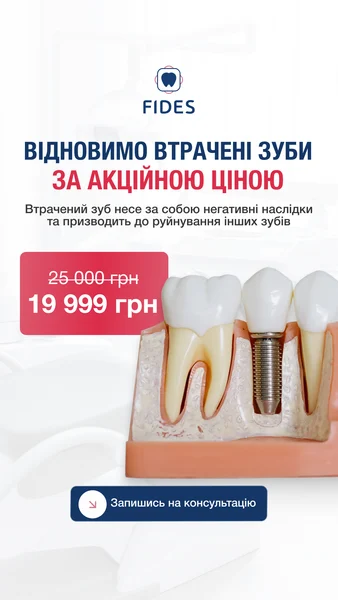 Fides — відновлення зубів